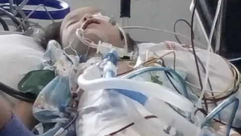 Handout Nasya, 4 was treated at the hospital after consuming tainted cough syrup