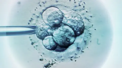 Science Photo Library Blue background, cells, close up