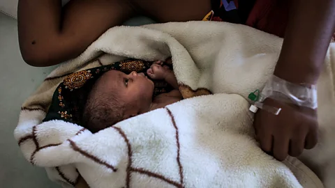 Getty Images ‘A C-section is just a second way of delivering’ (Credit: Getty Images)