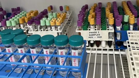 Qvin Menstrual blood samples in Qvin lab