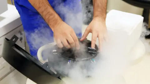 Getty Images Egg freezing procedure