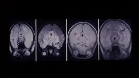 University of Nottingham Brain scans