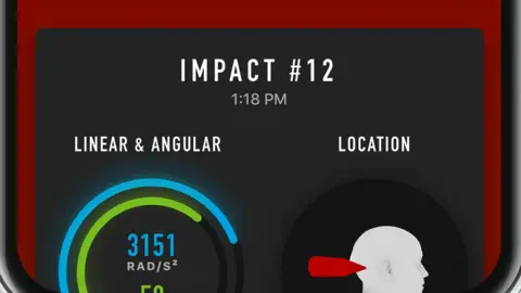 Prevent Biometrics head injury alert