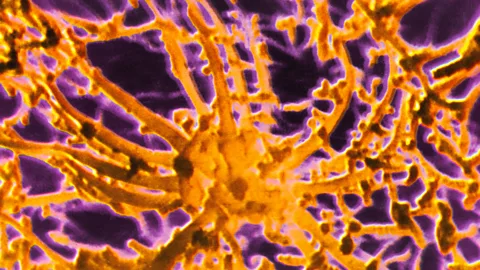 SPL The smell receptors in our nose can pick up odours perfectly well, but pheromones are a different matter (Credit: SPL)